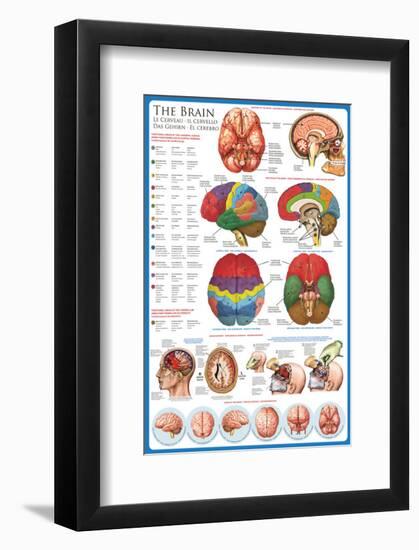 The Brain-null-Framed Premium Giclee Print