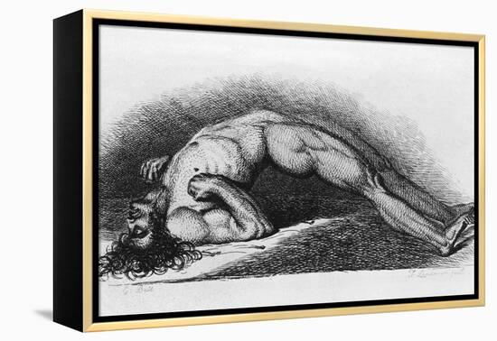 The Contracted Body of Soldier Suffering from Tetanus-Charles Bell-Framed Stretched Canvas