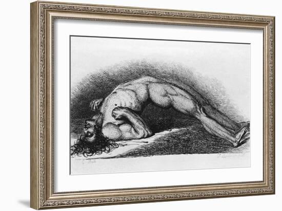 The Contracted Body of Soldier Suffering from Tetanus-Charles Bell-Framed Art Print