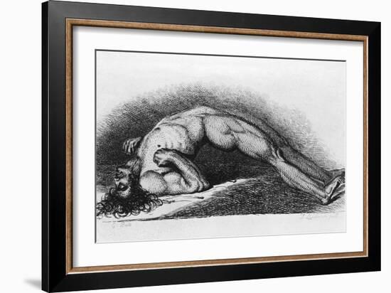 The Contracted Body of Soldier Suffering from Tetanus-Charles Bell-Framed Art Print