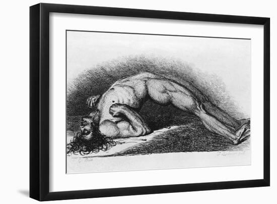 The Contracted Body of Soldier Suffering from Tetanus-Charles Bell-Framed Art Print