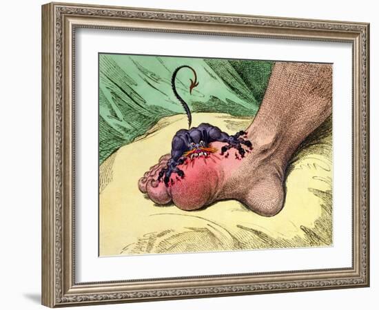 The Gout, Published by Hannah Humphrey in 1799-James Gillray-Framed Giclee Print