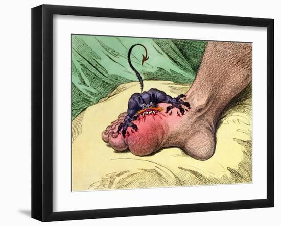 The Gout, Published by Hannah Humphrey in 1799-James Gillray-Framed Giclee Print