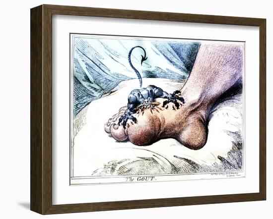 The Gout-null-Framed Giclee Print