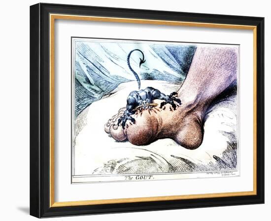 The Gout-null-Framed Giclee Print