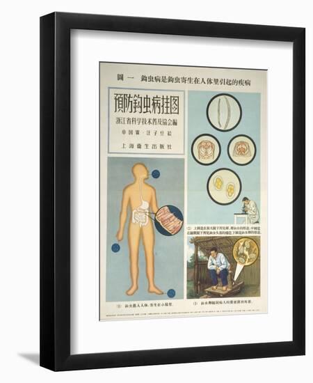 The Growth and Spread of Hookworms-null-Framed Premium Giclee Print