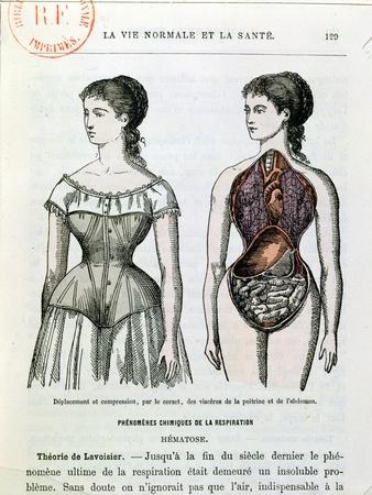 The Harmful Effects of the Corset, Illustration from La Vie Normale Et La  Sante' Giclee Print