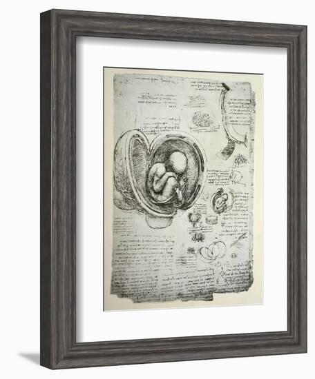 The Human Foetus in the Womb, Facsimile Copy-Leonardo da Vinci-Framed Giclee Print