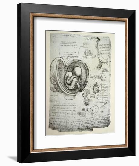 The Human Foetus in the Womb, Facsimile Copy-Leonardo da Vinci-Framed Giclee Print