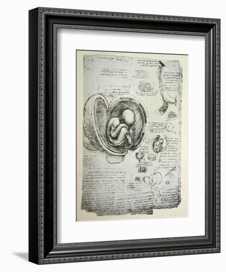 The Human Foetus in the Womb, Facsimile Copy-Leonardo da Vinci-Framed Giclee Print