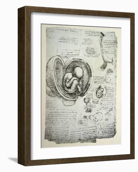 The Human Foetus in the Womb, Facsimile Copy-Leonardo da Vinci-Framed Giclee Print