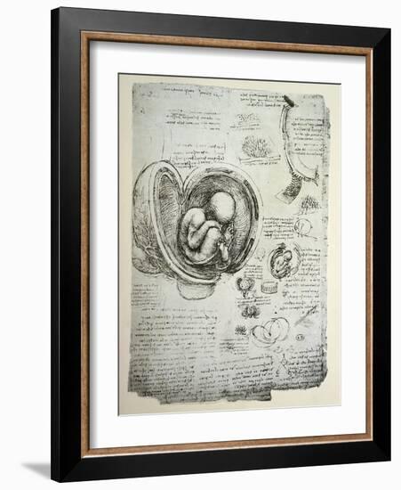 The Human Foetus in the Womb, Facsimile Copy-Leonardo da Vinci-Framed Giclee Print