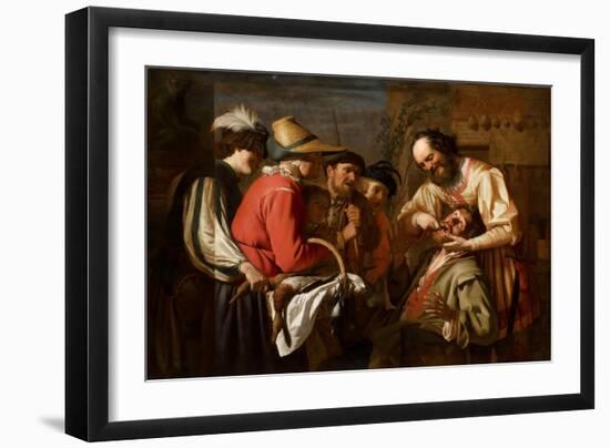 The Tooth Puller-Gerrit van Honthorst-Framed Giclee Print