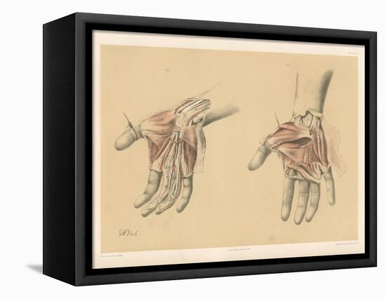 The Upper Limb. Superficial and Deep Views of the Palm of the Hand-G. H. Ford-Framed Premier Image Canvas