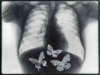 X-ray of butterflies in the stomach-Thom Lang-Photographic Print