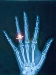 X-ray of hand with diamond ring-Thom Lang-Photographic Print