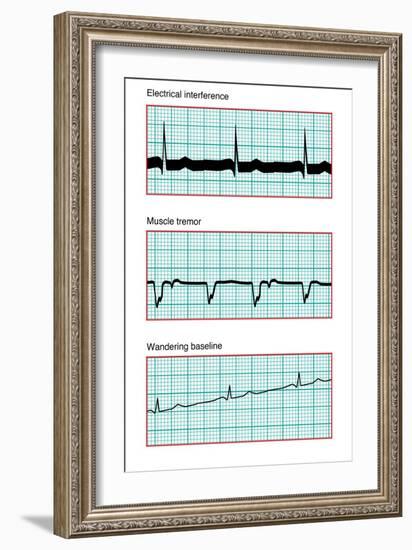 Three Electrocardiograms, Artwork-Peter Gardiner-Framed Photographic Print