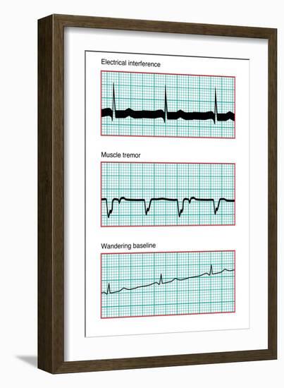 Three Electrocardiograms, Artwork-Peter Gardiner-Framed Photographic Print