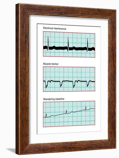 Three Electrocardiograms, Artwork-Peter Gardiner-Framed Photographic Print