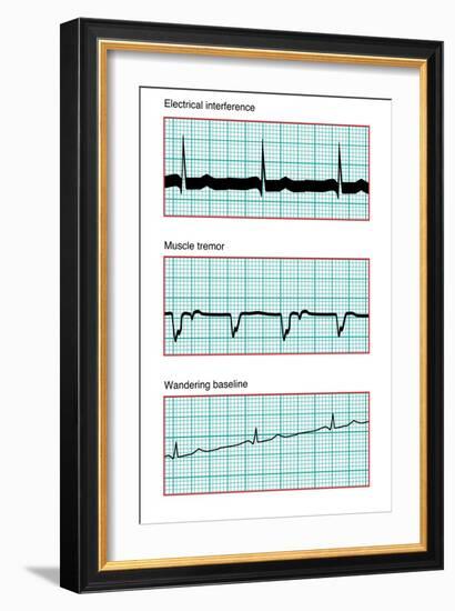 Three Electrocardiograms, Artwork-Peter Gardiner-Framed Photographic Print