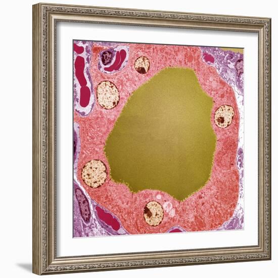 Thyroid Gland Follicle, TEM-Steve Gschmeissner-Framed Premium Photographic Print