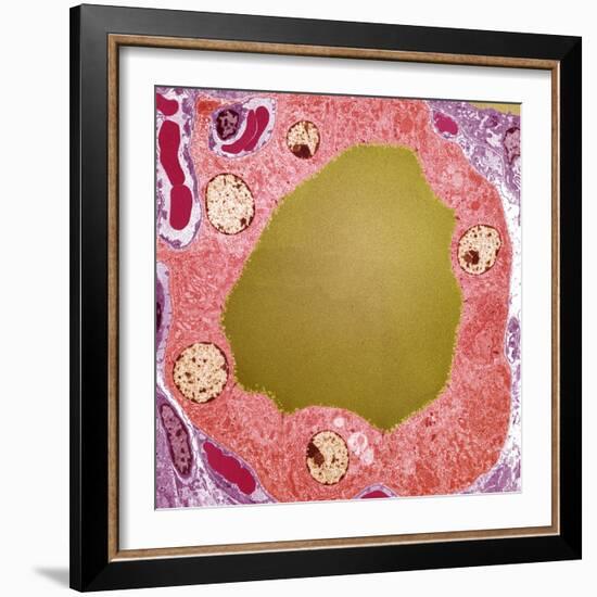 Thyroid Gland Follicle, TEM-Steve Gschmeissner-Framed Premium Photographic Print