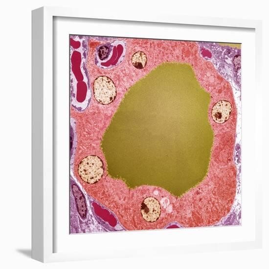 Thyroid Gland Follicle, TEM-Steve Gschmeissner-Framed Premium Photographic Print