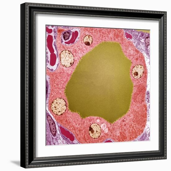 Thyroid Gland Follicle, TEM-Steve Gschmeissner-Framed Premium Photographic Print