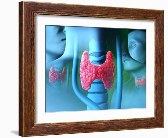 Thyroid Gland-David Mack-Framed Photographic Print