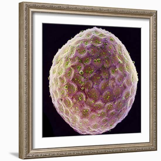 Tobacco Plant Protoplast, SEM-Dr. Jeremy Burgess-Framed Premium Photographic Print