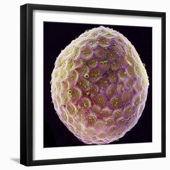 Tobacco Plant Protoplast, SEM-Dr. Jeremy Burgess-Framed Premium Photographic Print