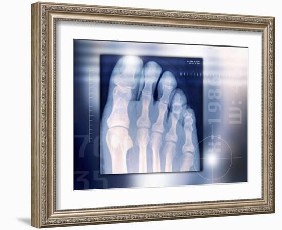 Toes, X-ray-Miriam Maslo-Framed Photographic Print
