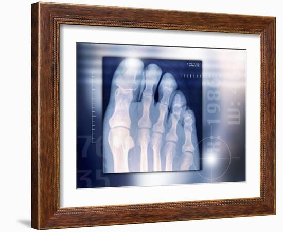 Toes, X-ray-Miriam Maslo-Framed Photographic Print