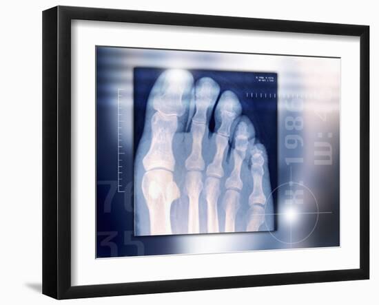 Toes, X-ray-Miriam Maslo-Framed Photographic Print