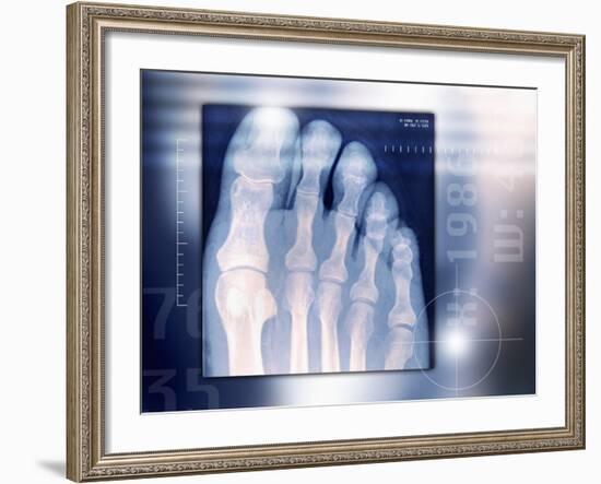 Toes, X-ray-Miriam Maslo-Framed Photographic Print