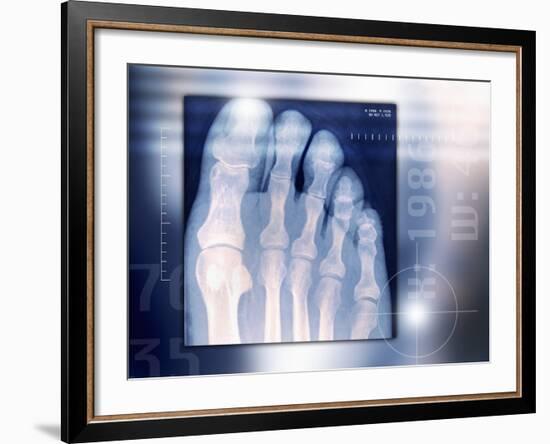 Toes, X-ray-Miriam Maslo-Framed Photographic Print