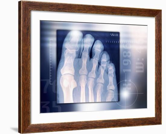 Toes, X-ray-Miriam Maslo-Framed Photographic Print