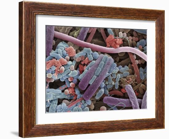 Tongue Bacteria, SEM-Steve Gschmeissner-Framed Photographic Print