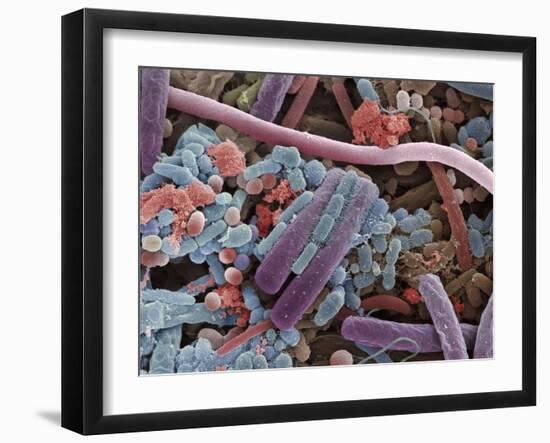 Tongue Bacteria, SEM-Steve Gschmeissner-Framed Photographic Print