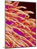 Tongue filiform papillae of a rabbit magnified x300-Micro Discovery-Mounted Photographic Print