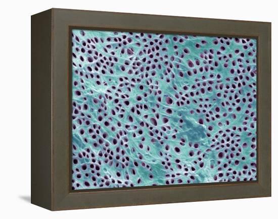 Tooth Dentine, SEM-Steve Gschmeissner-Framed Premier Image Canvas