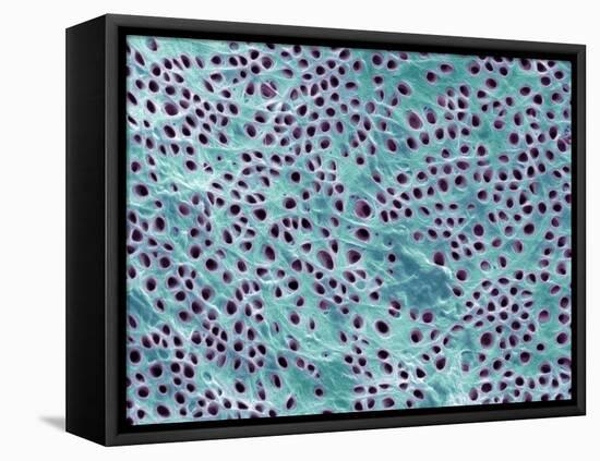 Tooth Dentine, SEM-Steve Gschmeissner-Framed Premier Image Canvas