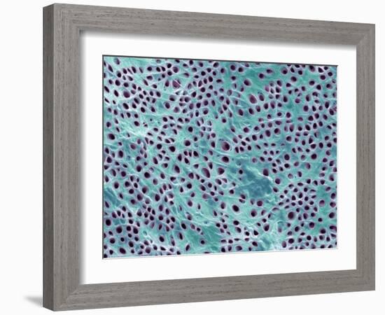 Tooth Dentine, SEM-Steve Gschmeissner-Framed Photographic Print