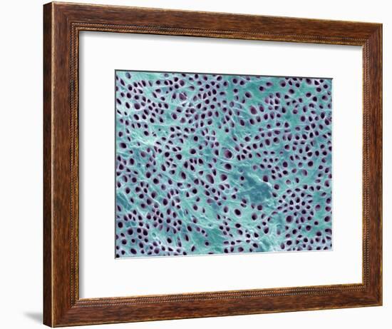 Tooth Dentine, SEM-Steve Gschmeissner-Framed Photographic Print