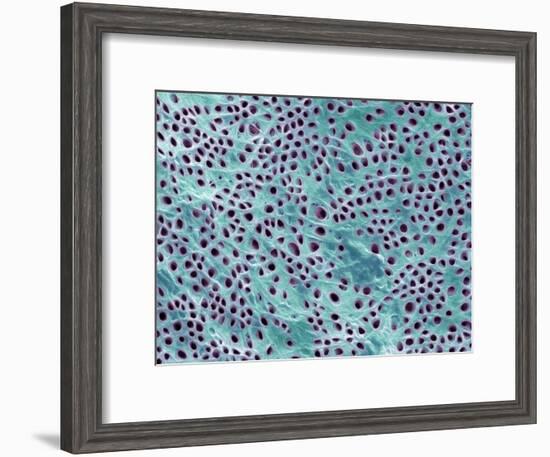 Tooth Dentine, SEM-Steve Gschmeissner-Framed Photographic Print