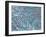 Tooth Dentine, SEM-Steve Gschmeissner-Framed Photographic Print