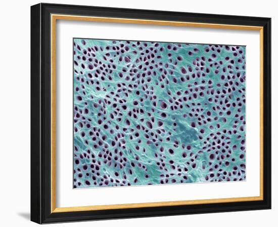 Tooth Dentine, SEM-Steve Gschmeissner-Framed Photographic Print