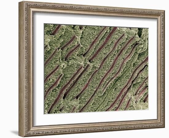 Tooth Dentine, SEM-Steve Gschmeissner-Framed Photographic Print