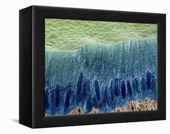 Tooth Enamel Formation, SEM-Steve Gschmeissner-Framed Premier Image Canvas