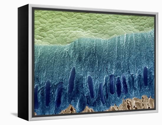 Tooth Enamel Formation, SEM-Steve Gschmeissner-Framed Premier Image Canvas